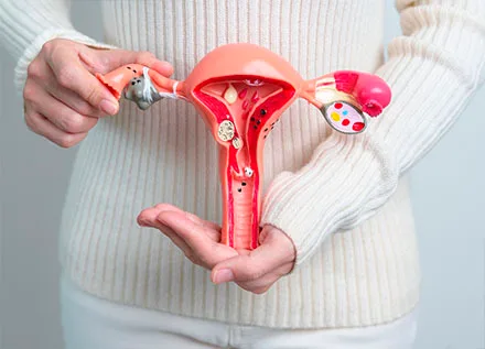 Adenomyosis
