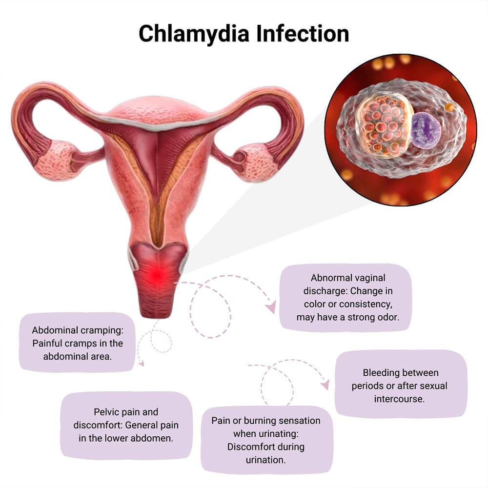 Chlamydia Treatment in Midtown, Manhattan