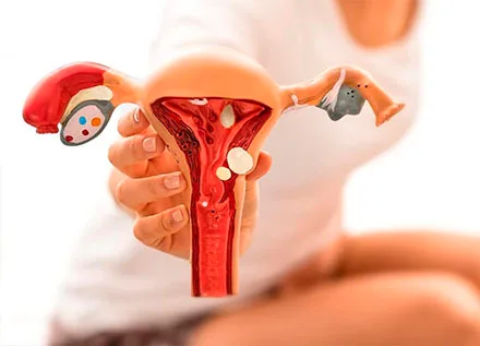 Dilation and Curettage (D&C)