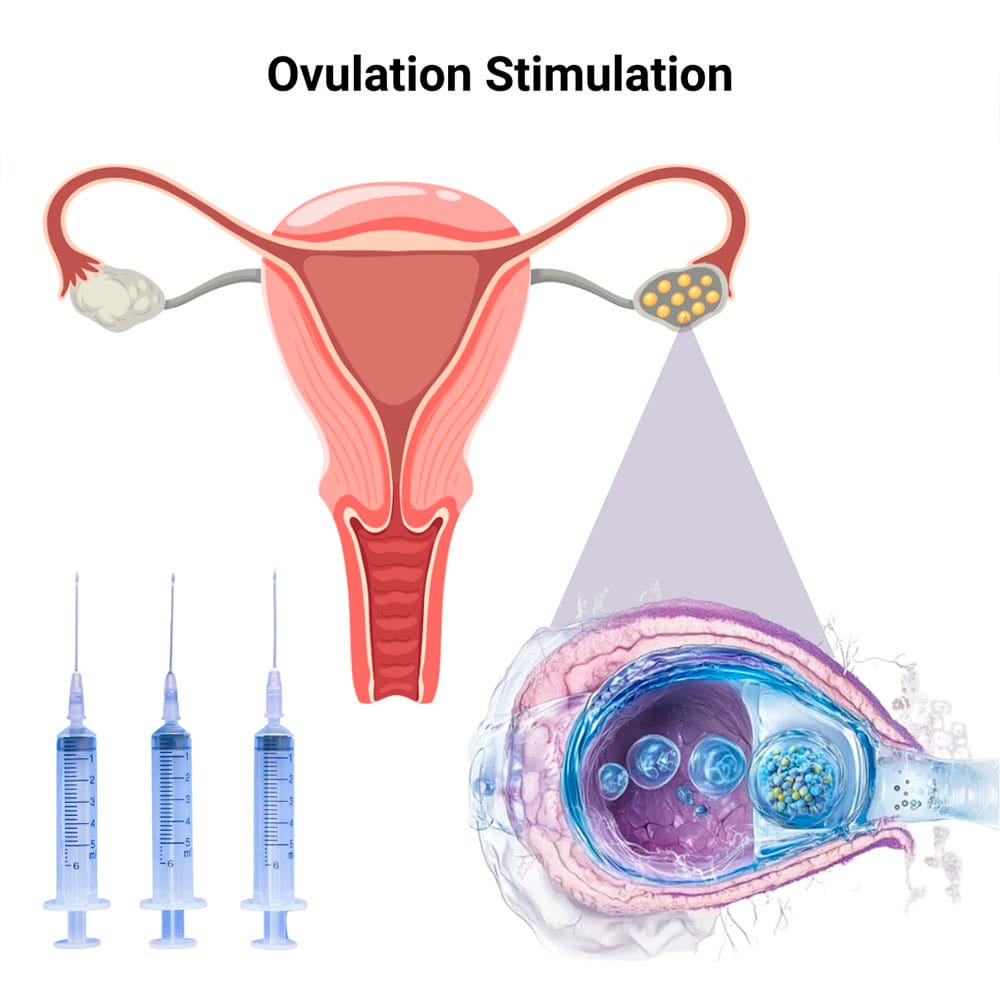 Ovulation Stimulation in Midtown Manhattan