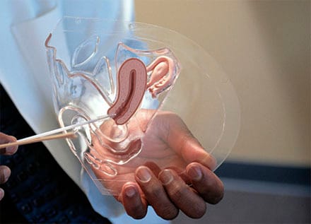 Vaginal Rejuvenation