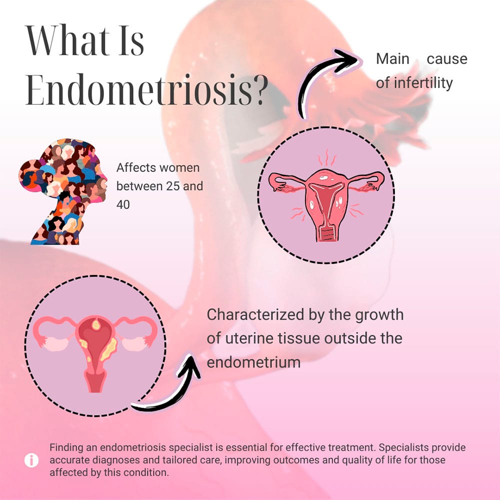 What is Endometriosis?