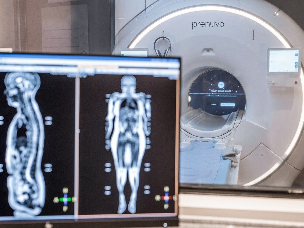 Prenuvo MRI3